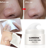 Blackhead nasal membrane with 60 sheets of blackhead tearing powerful to acne T area care